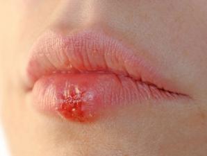 Перманентный татуаж губ с растушевкой фото до и после процедуры Перманентный макияж губ заживление