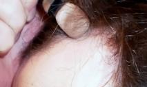 Линия роста волос на лбу: что это такое и можно ли ее скорректировать Линия роста волос на голове у женщин